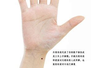 左手腕上有痣|女人左手腕有痣全图解 女人左手腕有痣旺夫